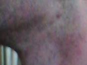 Patovicas agredieron físicamente joven conocido boliche