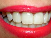 Dientes Blancos Peligro