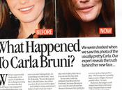 Celebrities adicción botox