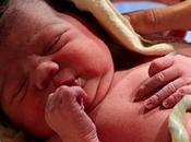 argumentos favor demorar corte cordón umbilical recién nacidos