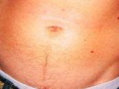 Ejercicios para perder barriga