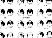Sobre alopecia