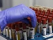 Varias investigaciones marcha para detectar cáncer sangre