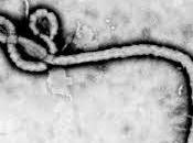 Científicos argumentan “Peste Negra” debió ébola, peste bubónica