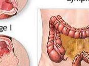 Cómo Holística medicamento utiliza para tratar cáncer?