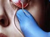 Serie: Strain