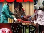 Virus Ebola Fiebre Hemorrágica Países Occidentales