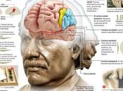 Cerebro Einstein fisura hace diferencia)