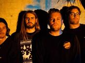 Main Beach: Hypo Lazy