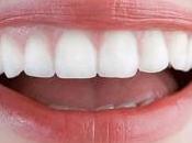 Mitos verdades sobre blanqueamiento dental
