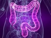 Cómo tratar síndrome intestino irritable colon