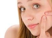 Buenos hábitos acné