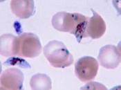 Malaria