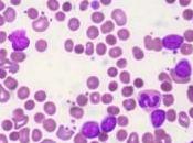 ¿Tengo anemia?