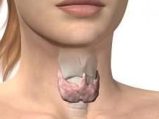 Problemas tiroides: Extremos nunca fueron buenas