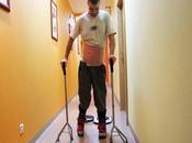 Parapléjico vuelve caminar tras trasplante células olfativas