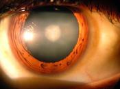 Enfermedades retina afectan vista