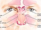 Tips para aliviar sinusitis