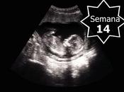 Semana embarazo