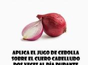 Alopecia como enfrentarla