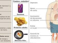 Obesidad infantil, riesgos