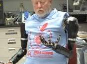 Primer implante brazos robóticos nivel hombro