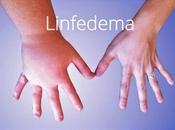 ¿Qué Linfedema?