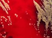 Encuentran primera casos infección humanos bacteria suelo