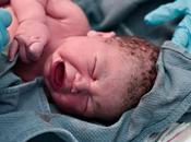 nacimiento prematuro puede alterar conexiones cerebrales