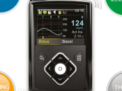 Nuevo sistema MiniMed 640G: infusión insulina medición continua