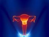 terapia hormonal para menopausia aumenta riesgo sangrado gastrointestinal
