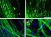Fibras musculares cultivadas laboratorio ofrecen nuevo modelo para distrofia muscular Ducchene