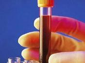 Biopsias líquidas