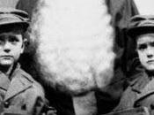 Single Navideño Hurts