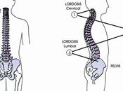 ¿Cómo mejorar postura?