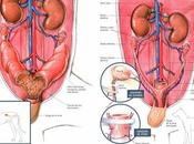 ¿Qué piometra? Causas síntomas
