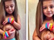 Virsaviya Borun-Goncharova, niña vive corazón fuera pecho