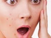 mejor tratamiento acné acudir dermatólogo