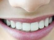 mejores implantes dentales Málaga solo cuatro pasos