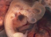 ¿Cuándo debe tomar ácido fólico?