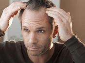 Soluciones para alopecia