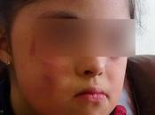 Escuela Rafaela Arganiz entrega golpeada hija