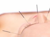 Método acupuntura Berkley para prevenir aborto Involuntario