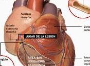 SALUD: Estudios sobre alimentación vegetariana enfermedad cardiovascular