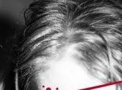 Sarna gusto César Pérez Gellida