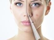 Cinco maneras eliminar cicatrices piel
