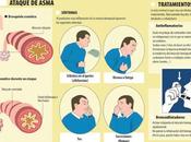 Asma Alergia: Causas Tratamiento