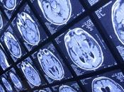 Neurociencia: evitar desengaño Investigación Ciencia