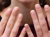 consejos para cuidar uñas quebradizas