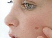 Diagnóstico precoz cáncer piel